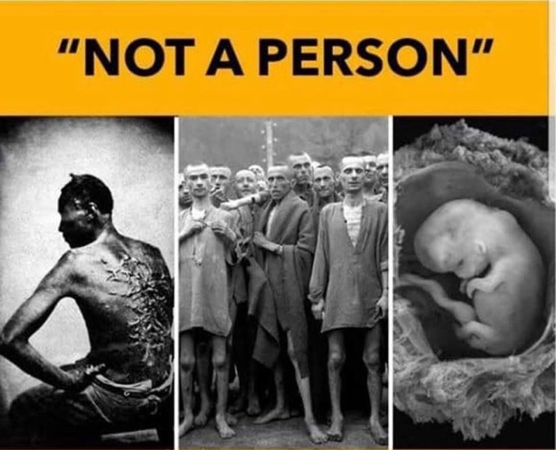 Abortion Not a Person 02